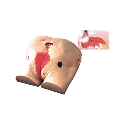 Decubitus Ulcer Care Model | INNORKOM 1