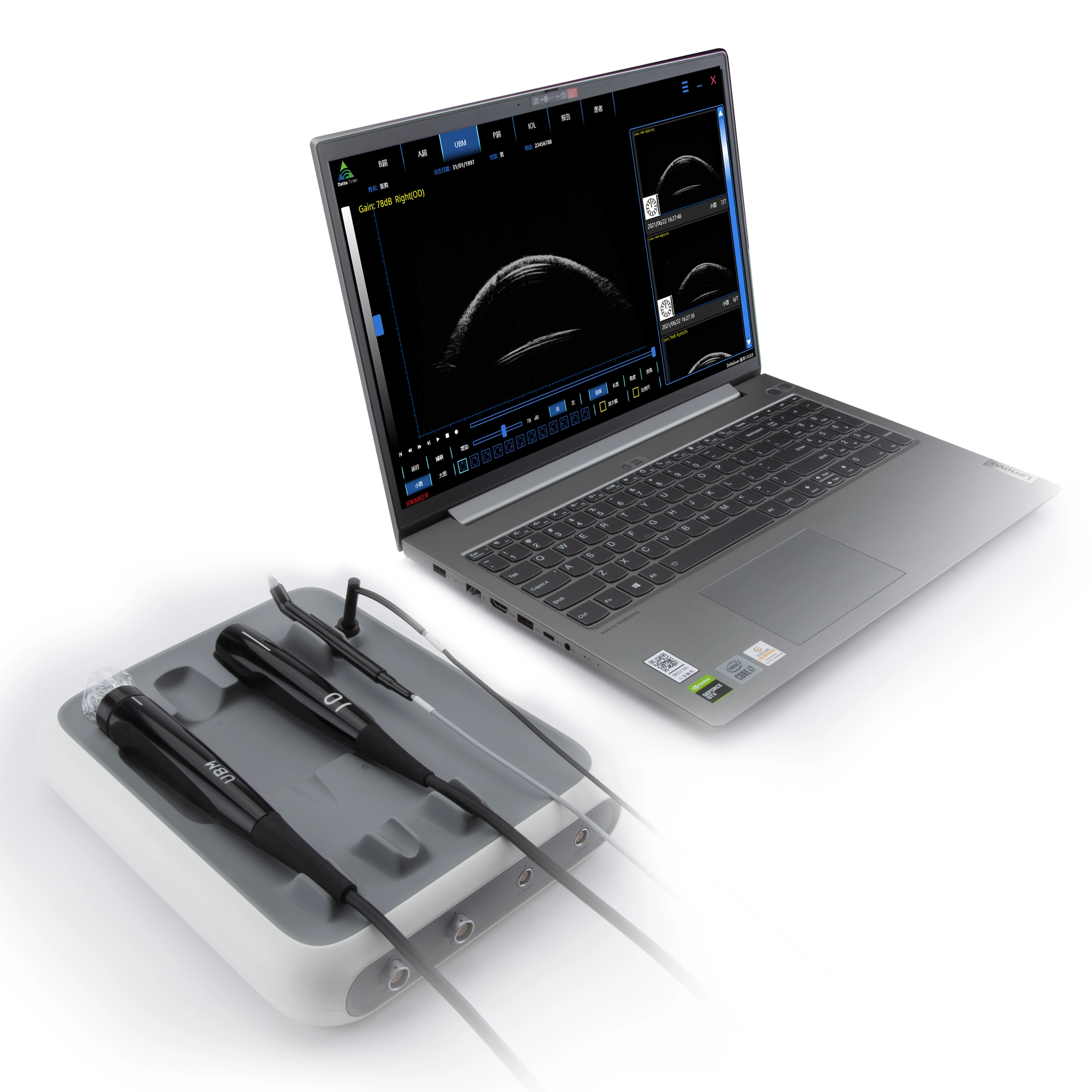 Ophthalmic Ultrasound 4 in 1 Scanner AB-SCAN Pachymeter with UBM | INNORKOM 1