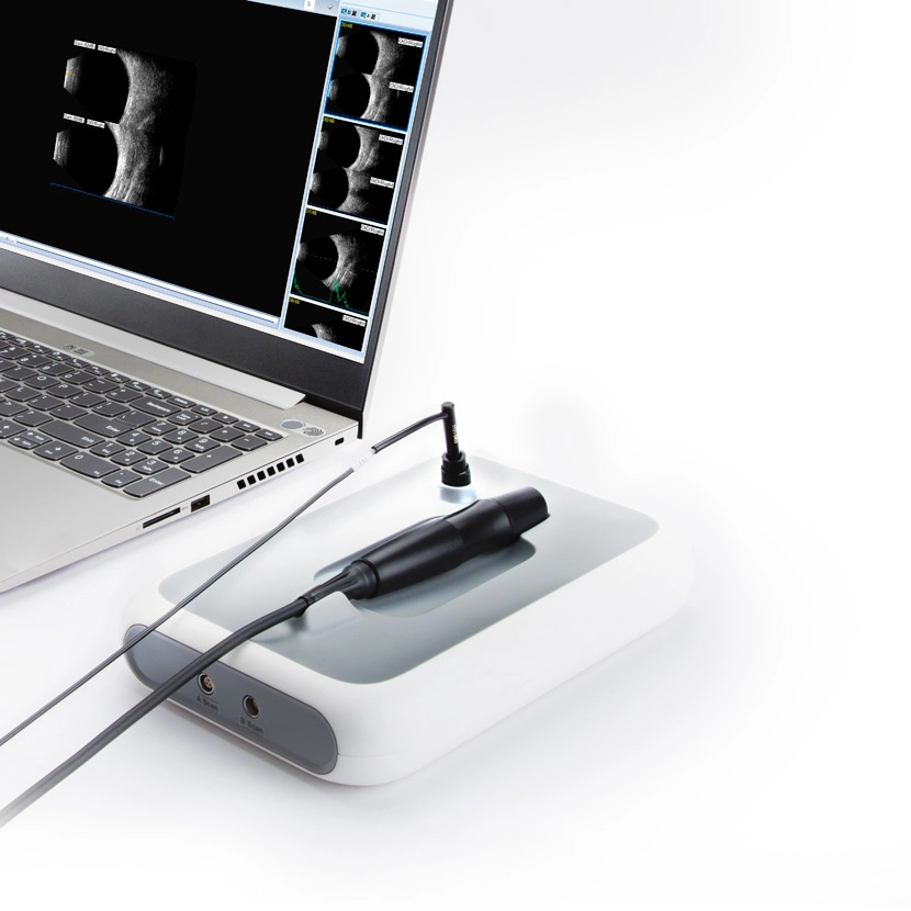 Escáner de diagnóstico oftálmico AB Scan 2 en 1 | INNORKOM 1