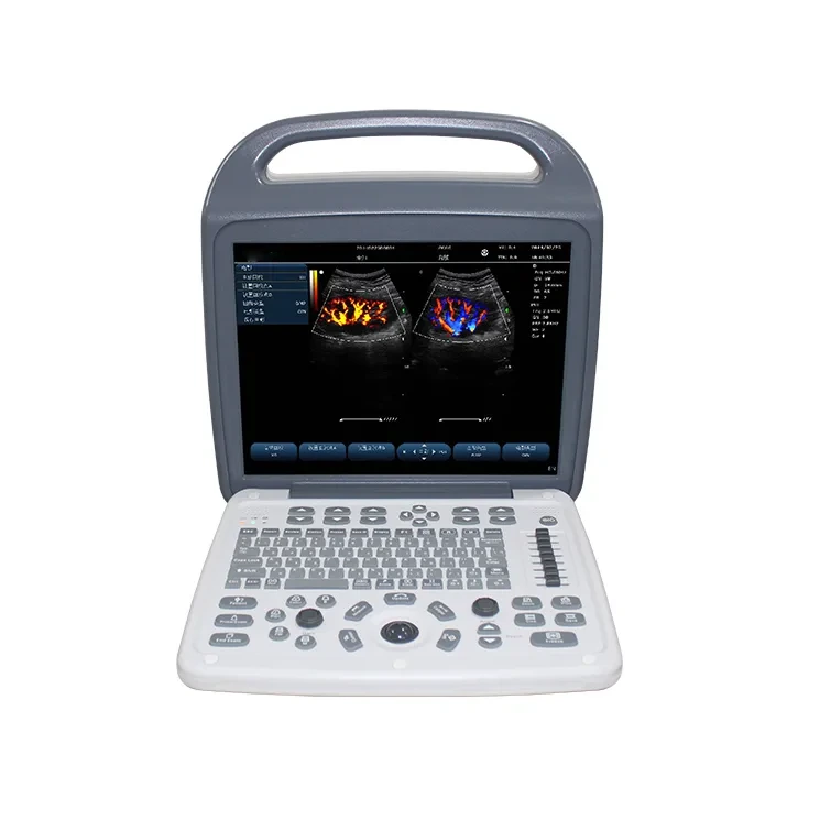 15-inch LCD Color Doppler Ultrasound Scanner for Gynecology Cardiology Abdomen | INNORKOM 1