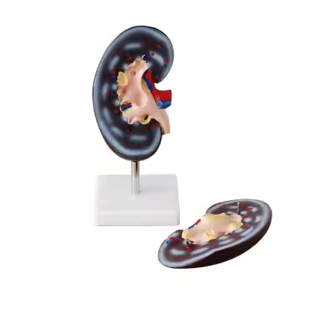 Kidney Model (2 parts) | INNORKOM 1