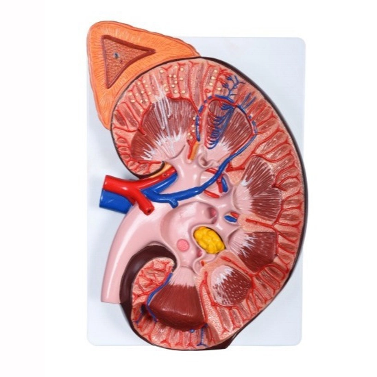 Enlarged Kidney Model 1 Part | INNORKOM 1