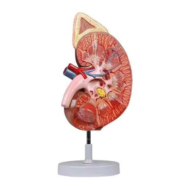 Kidney with Adrenal Magnified Model | INNORKOM 1