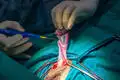 Icu Machine Manufacturer for Operating RoomVeterinary Surgical Procedures 10