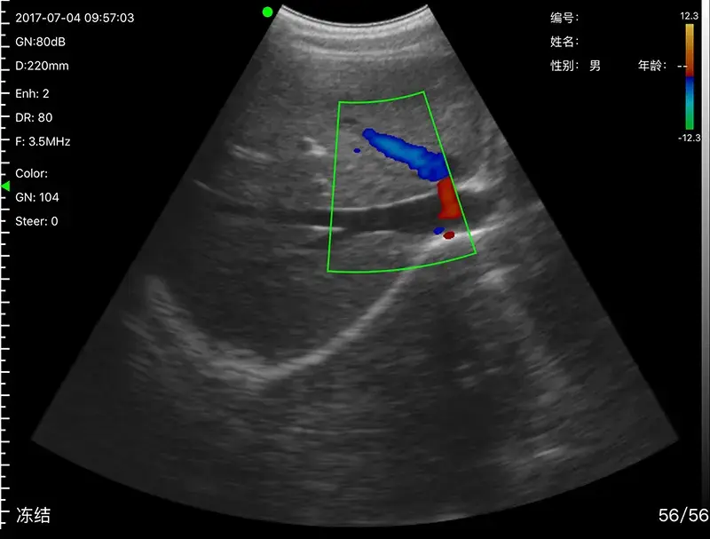 Durableultrasound Machine Vendors for Operating Room Electricity B/M 7