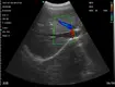Durableultrasound Machine Vendors for Operating Room Electricity B/M 7
