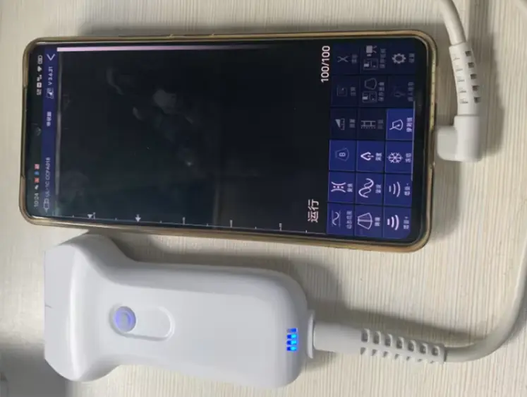 Ultrasound Machine Manufacturer for Medical Grade Linear 20/30/40/55mmmanufacturer 5