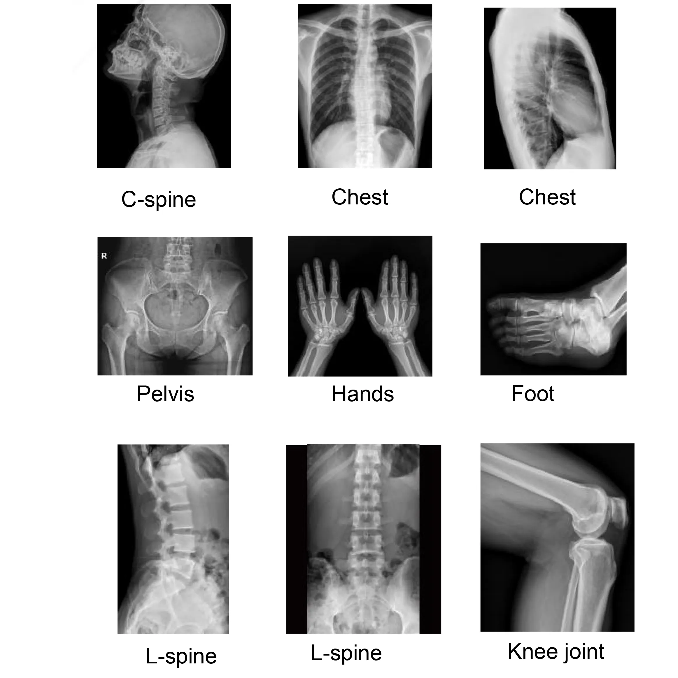 Wholesalesurgical Table for Sale for Operating Room INNORKOM X-ray Photography 10