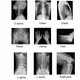 Wholesalesurgical Table for Sale for Operating Room INNORKOM X-ray Photography 10
