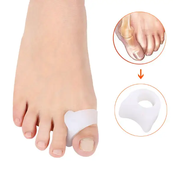 Bunion Corrector Ring and Bunion Relief-Pads for Overlapping Hallux valgus 1
