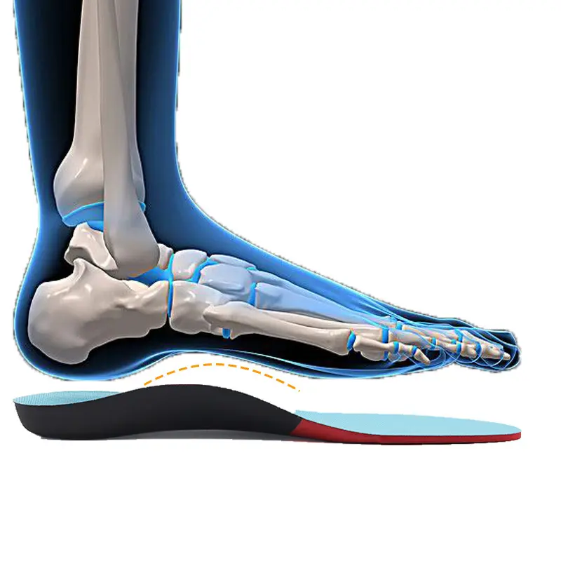 S-King best orthotics for arch support Supply for foot accessories 3
