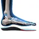 S-King best orthotics for arch support Supply for foot accessories 3