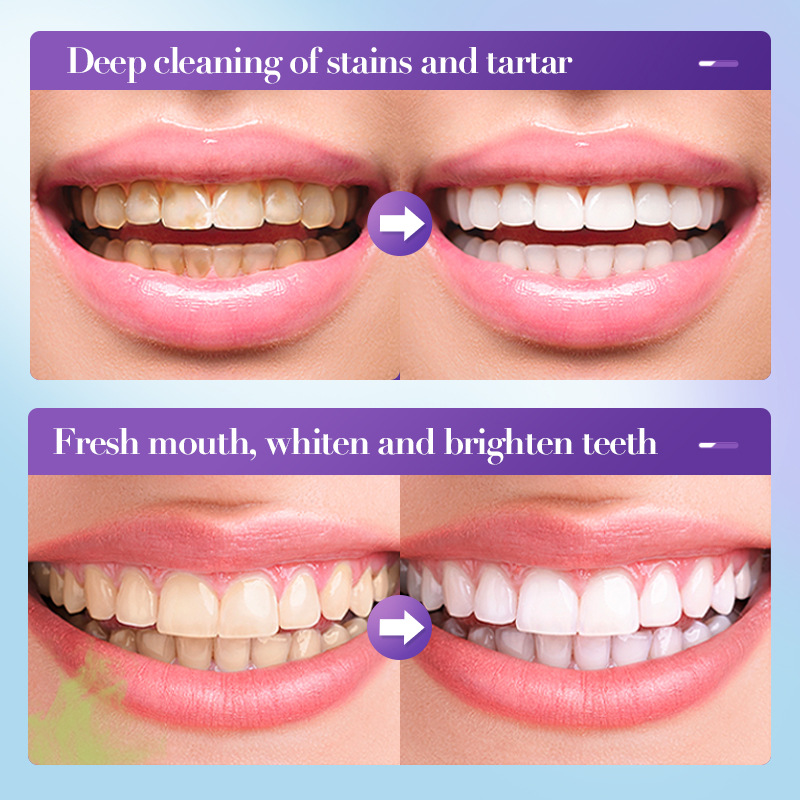 Purple Whitening Toothpaste 2