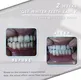 GlorySmile Custom high quality professional effects whitestrips for business for teeth 4