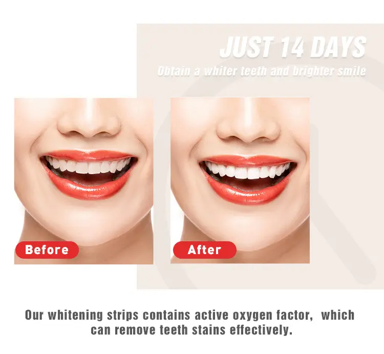 3D teeth cleaning strips manufacturers for home usage 4