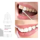 GlorySmile teeth whitening essence price Supply1 6