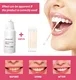 GlorySmile teeth whitening essence price Supply1 3