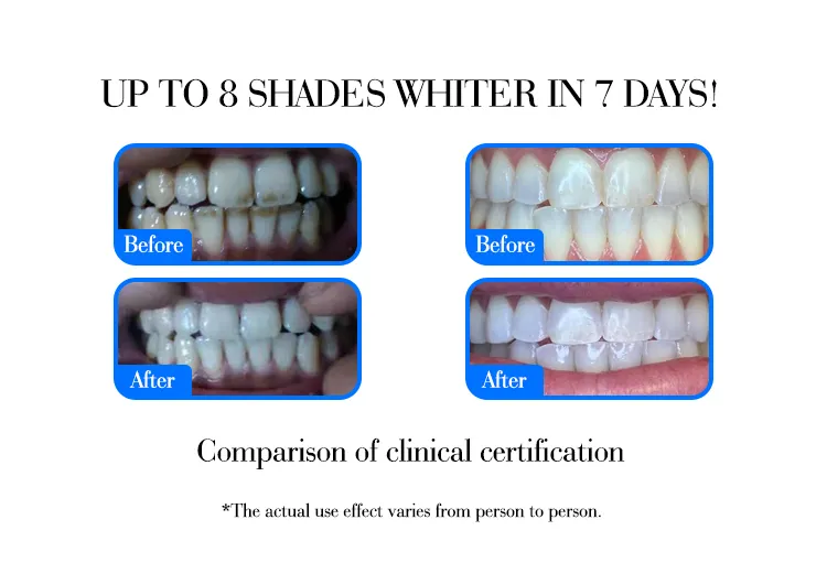 GlorySmile pap teeth whitening factory 5