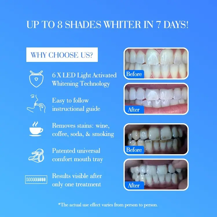 ODM high quality led whitening kit company for home usage 6