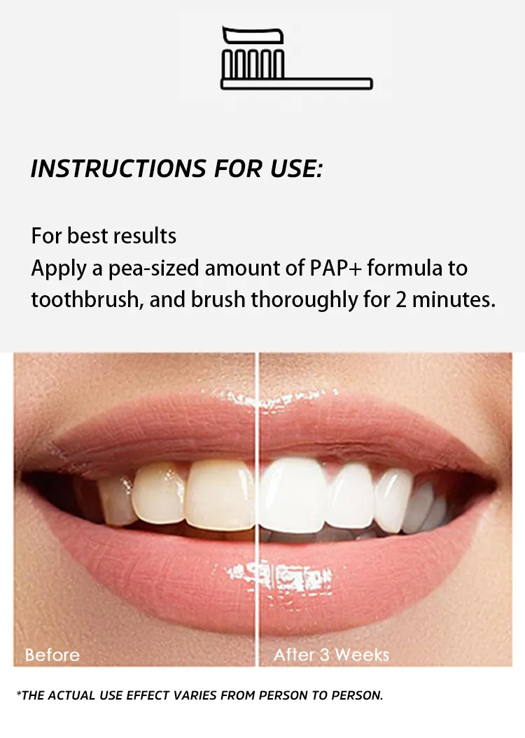 ODM high quality pap teeth whitening factory for teeth 7