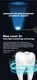 GlorySmile Bulk purchase custom automatic toothbrush company for teeth 4