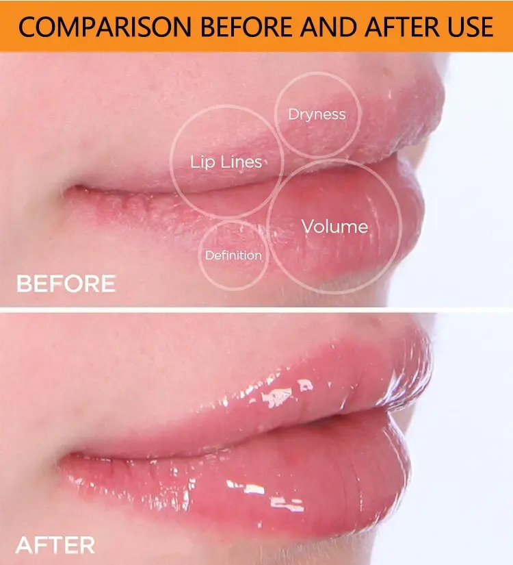 GlorySmile lip sleeping mask factory 6