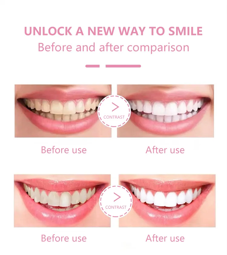 GlorySmile best activated charcoal powder reputable manufacturer for teeth1 8