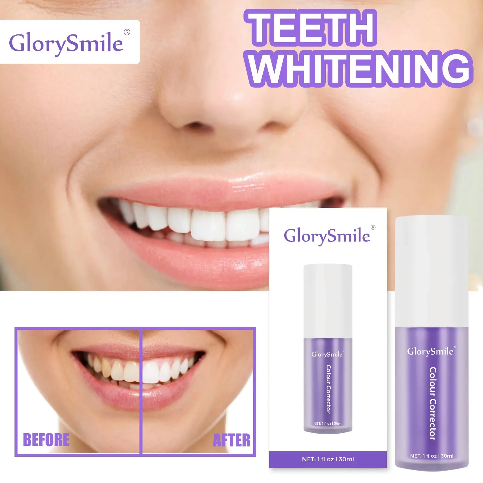 GlorySmile distributors for home usage 4