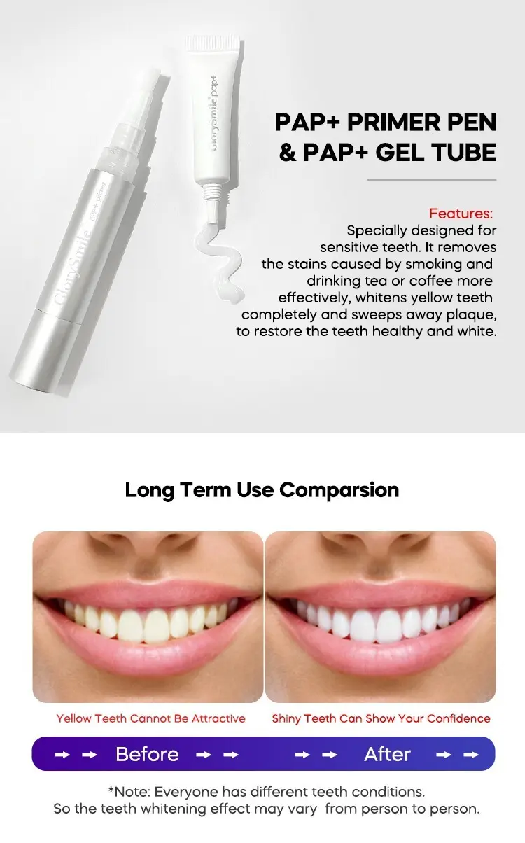 GlorySmile led top 10 home teeth whitening kits manufacturers 4