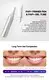 GlorySmile led top 10 home teeth whitening kits manufacturers 4