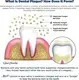 GlorySmile Bulk buy custom activated charcoal toothbrush Suppliers for whitening teeth 6