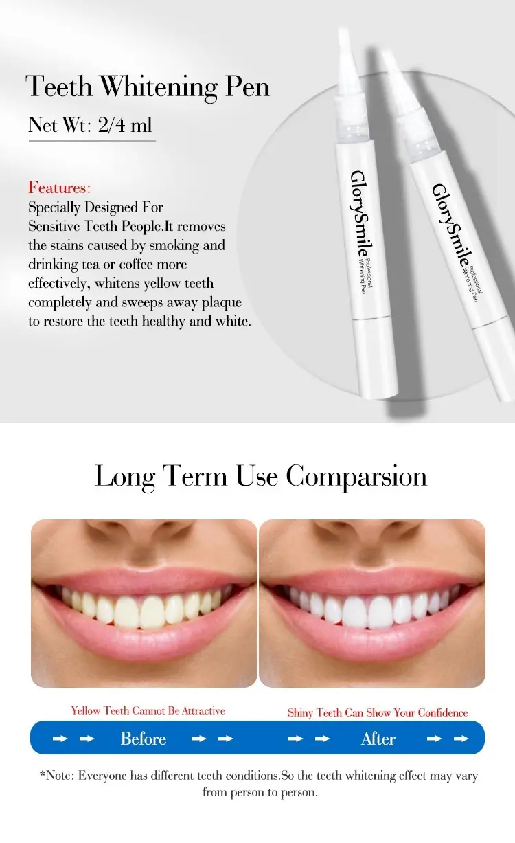 GlorySmile dental impression kit wholesale for home usage 6