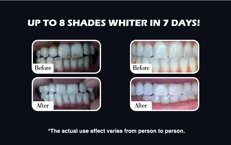 GlorySmile OEM high quality electric toothbrush for sensitive teeth company for whitening teeth 4