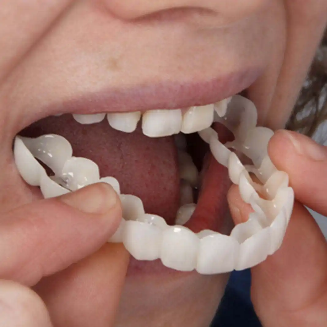 Wholesale Silicone Tray Fake Temporary Braces Cover Tooth Veneers Teeth Brace 1