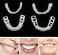 Bulk buy custom whitening trays online Supply 4