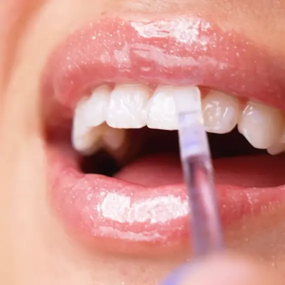 GlorySmile Bulk purchase high quality instant whitening pen manufacturers for home usage 5