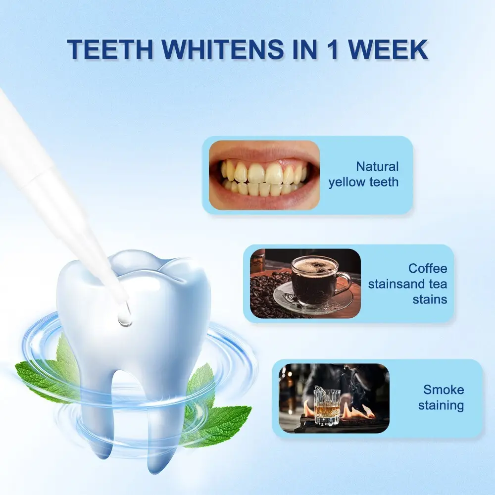 GlorySmile dentist teeth whitening kit company for teeth 7