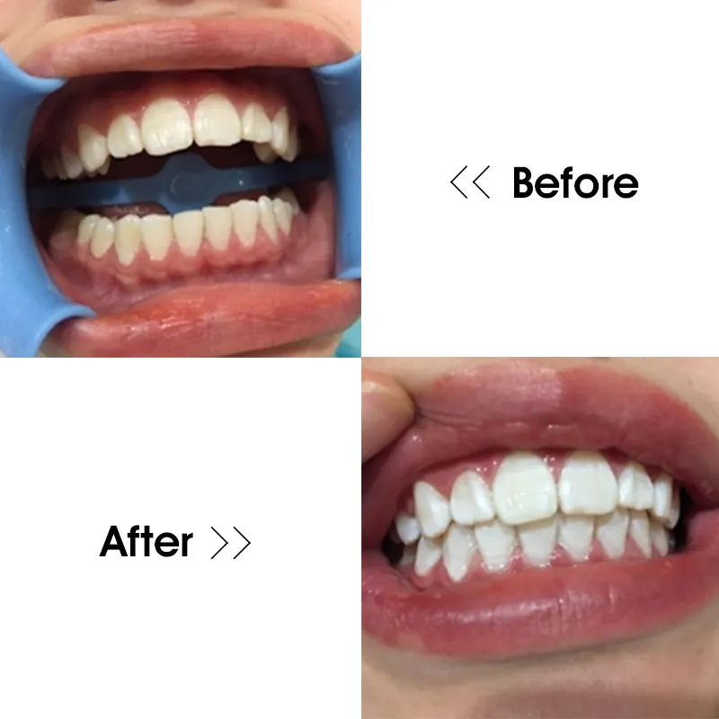GlorySmile Array image2