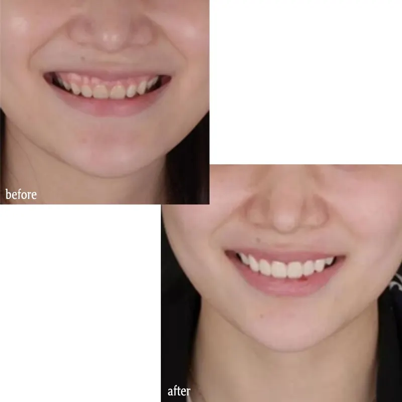 GlorySmile Array image84