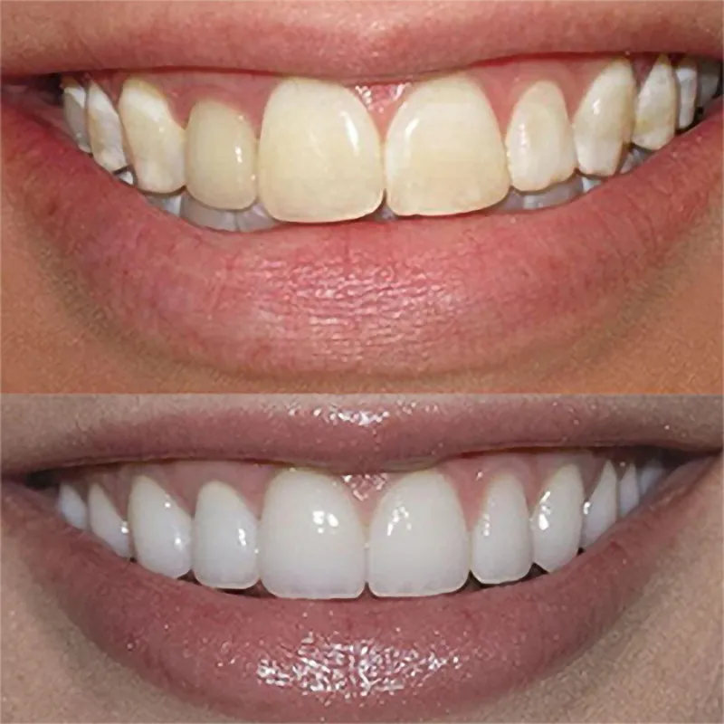 GlorySmile Array image803