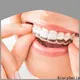 GlorySmile Custom ODM braces and aligners manufacturers for teeth 1
