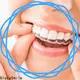 GlorySmile most affordable invisible aligners Supply for teeth 1