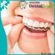 GlorySmile best teeth whitening trays manufacturers 1