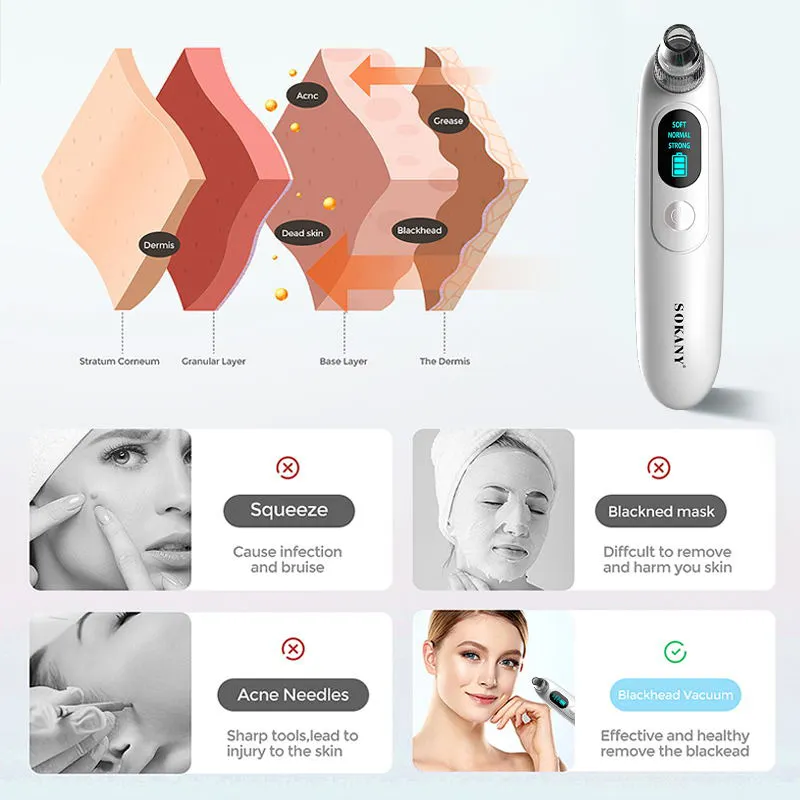 Topblackhead Remover Supplier 50/60Hz Variable Steam Control 6