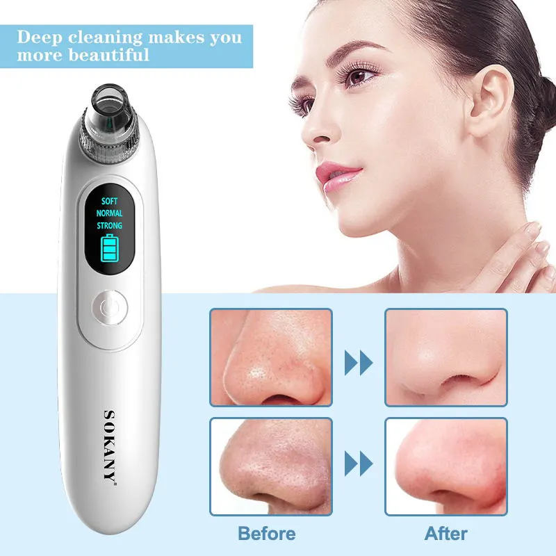 Topblackhead Remover Supplier 50/60Hz Variable Steam Control 3