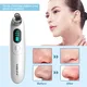 Topblackhead Remover Supplier 50/60Hz Variable Steam Control 3