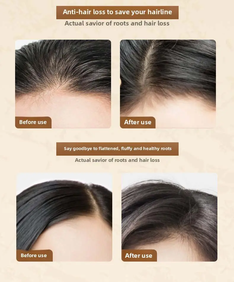 Triwell Hair Shampoo Manufacturer Hair Shampoo Manufacturer Factory Direct Supply 2