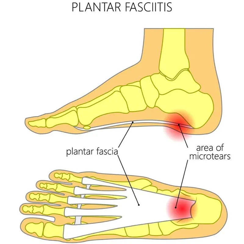 Cost-Effective Ankle Sleeve Manufacturer for Joint Strain Prevention 10